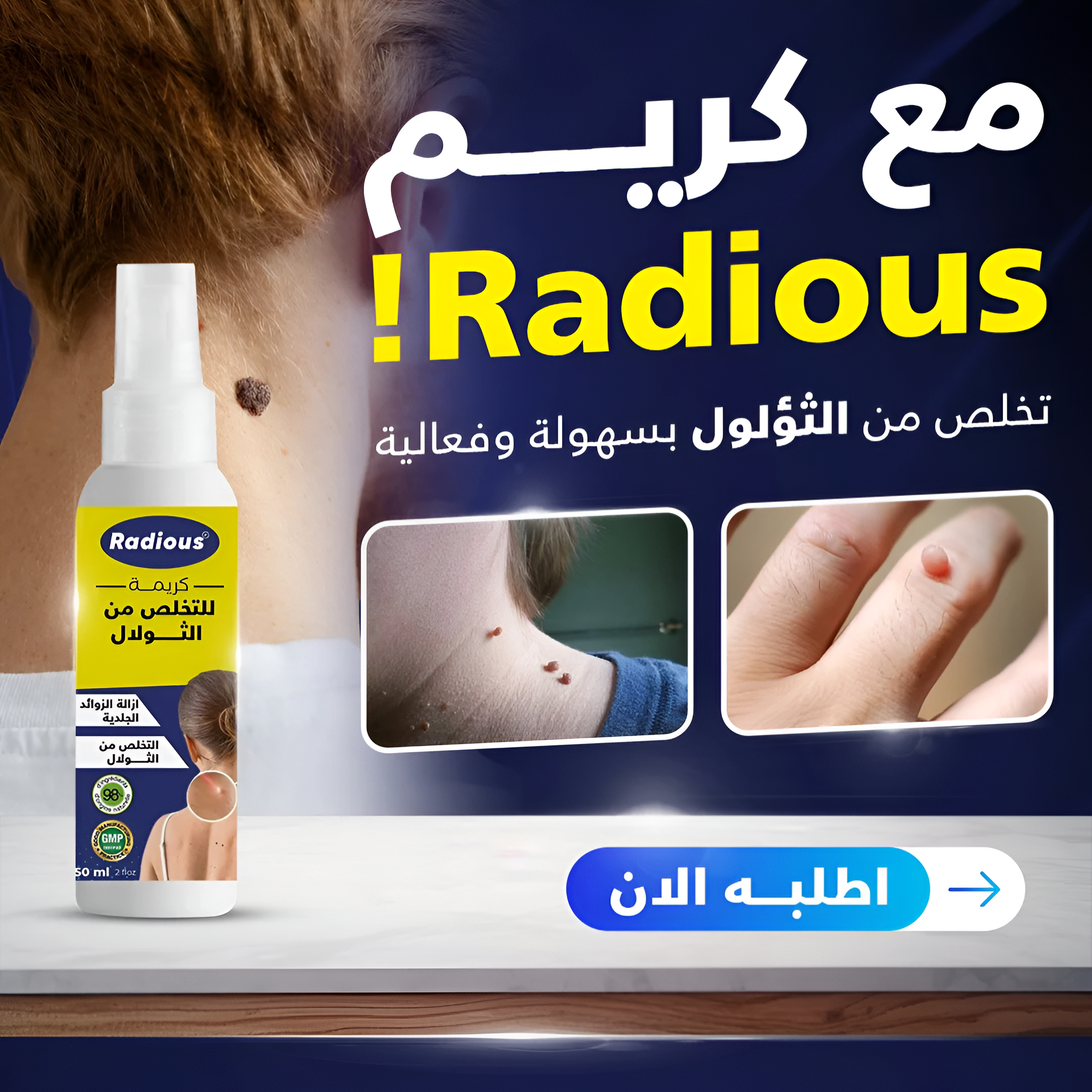 تخلص من الثولال بسهولة فعالة